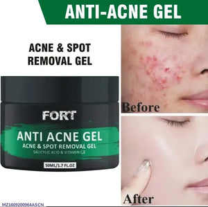 Fort Anti-Acne Gel Cream for Scar Removal & Anti-Aging